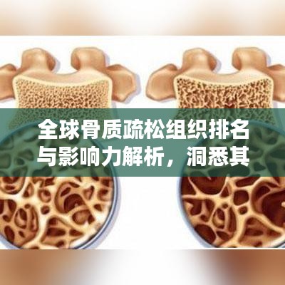 全球骨质疏松组织排名与影响力解析，洞悉其在世界舞台上的位置